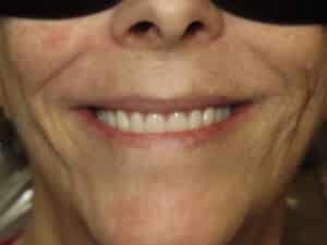 IMG 1208