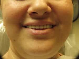 IMG 1427