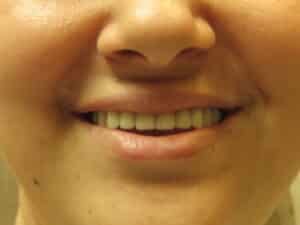 IMG 1428