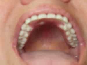 IMG 1434