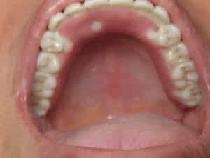 IMG 1436