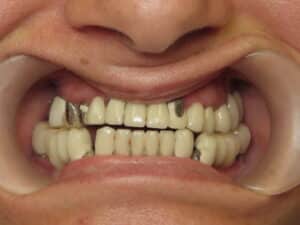 Leila Before
